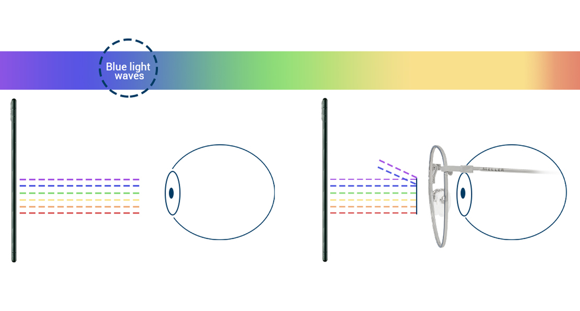 Hogyan működik a kékfény-szűrő