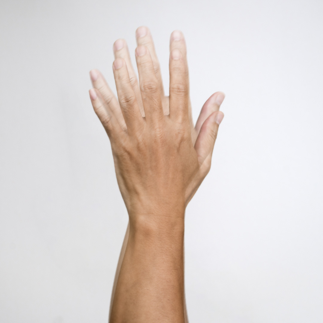 függőleges kettős látás