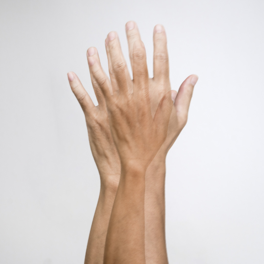 ferde kettős látás