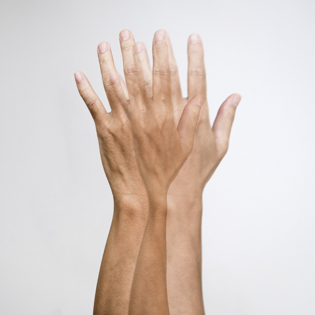 monokuláris kettős látás