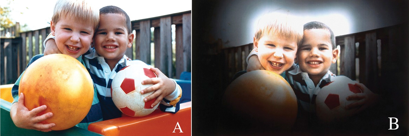 hogyan látnak a glaukómás emberek